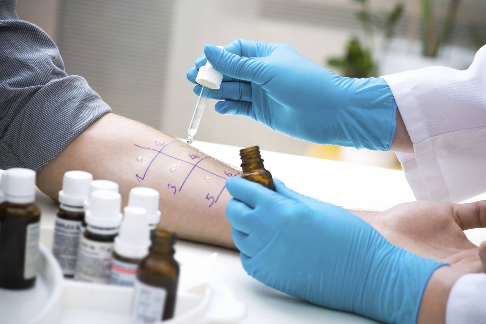 Control Skin Test Allergy Testing | ENT Associates of Worcester